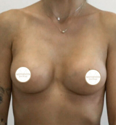 29b_mia_femtech_aesthevita_pilka-po