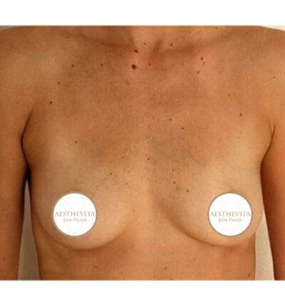 mia-femtech-012-pred-1