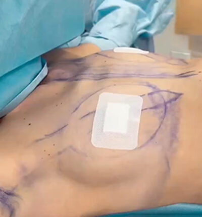 mia-femtech-030-pred