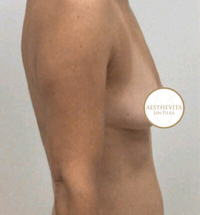 mia-femtech-034-pred