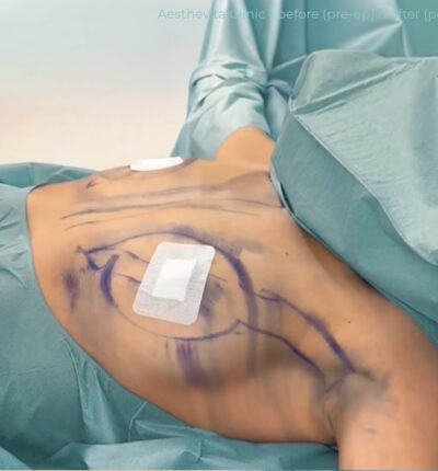 mia-femtech-044-pred-1