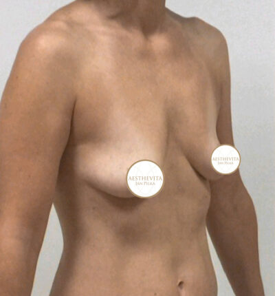 mia-femtech-051-pred